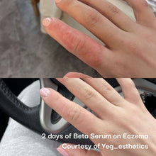 Load image into Gallery viewer, Beta Serum