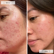 Load image into Gallery viewer, Omnilux Clear - *Pre-order. Estimated 2-3 week shipping.