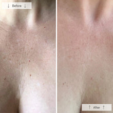 Load image into Gallery viewer, Omnilux Contour Neck &amp; Décolleté - *Pre-order. Estimated 2-3 week shipping.
